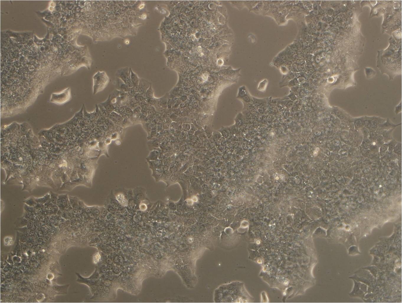 A-431 Cells|人皮肤鳞癌克隆细胞(包送STR鉴定报告)