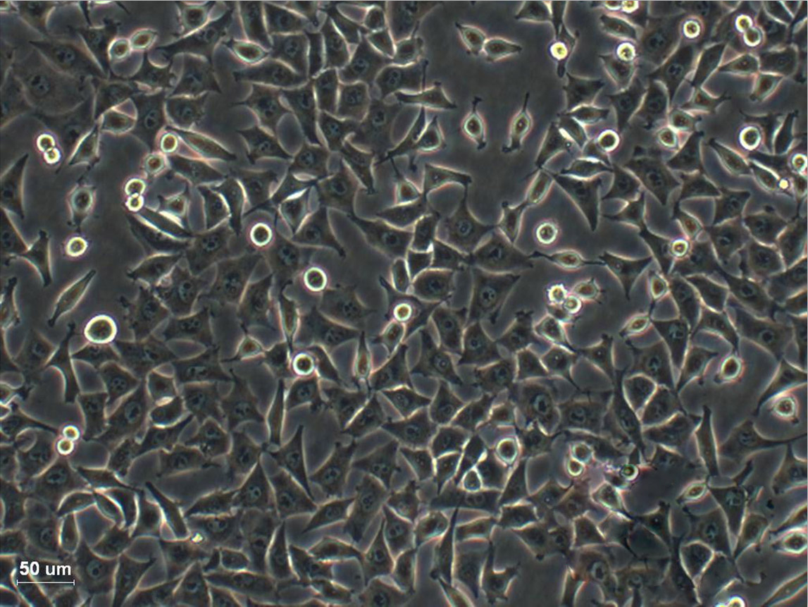 SV40 MES 13:小鼠肾小球系膜复苏细胞(提供STR鉴定图谱)