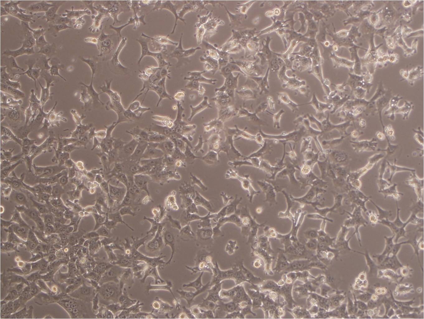 MDA-MB-231-luc:人乳腺癌复苏细胞(提供STR鉴定图谱)
