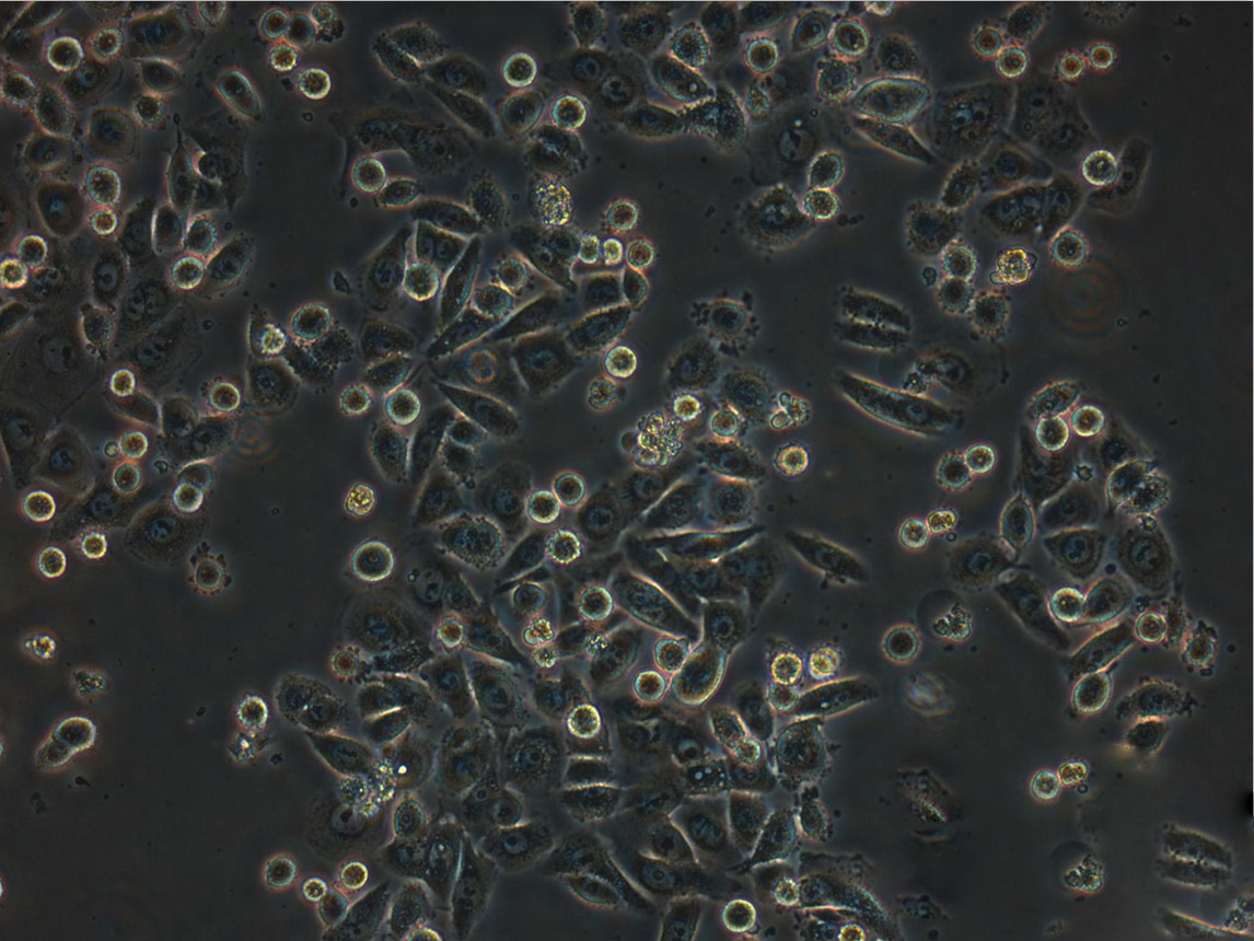 RCM-1 [Human rectum adenocarcinoma]:人胰腺癌复苏细胞(提供STR鉴定图谱)