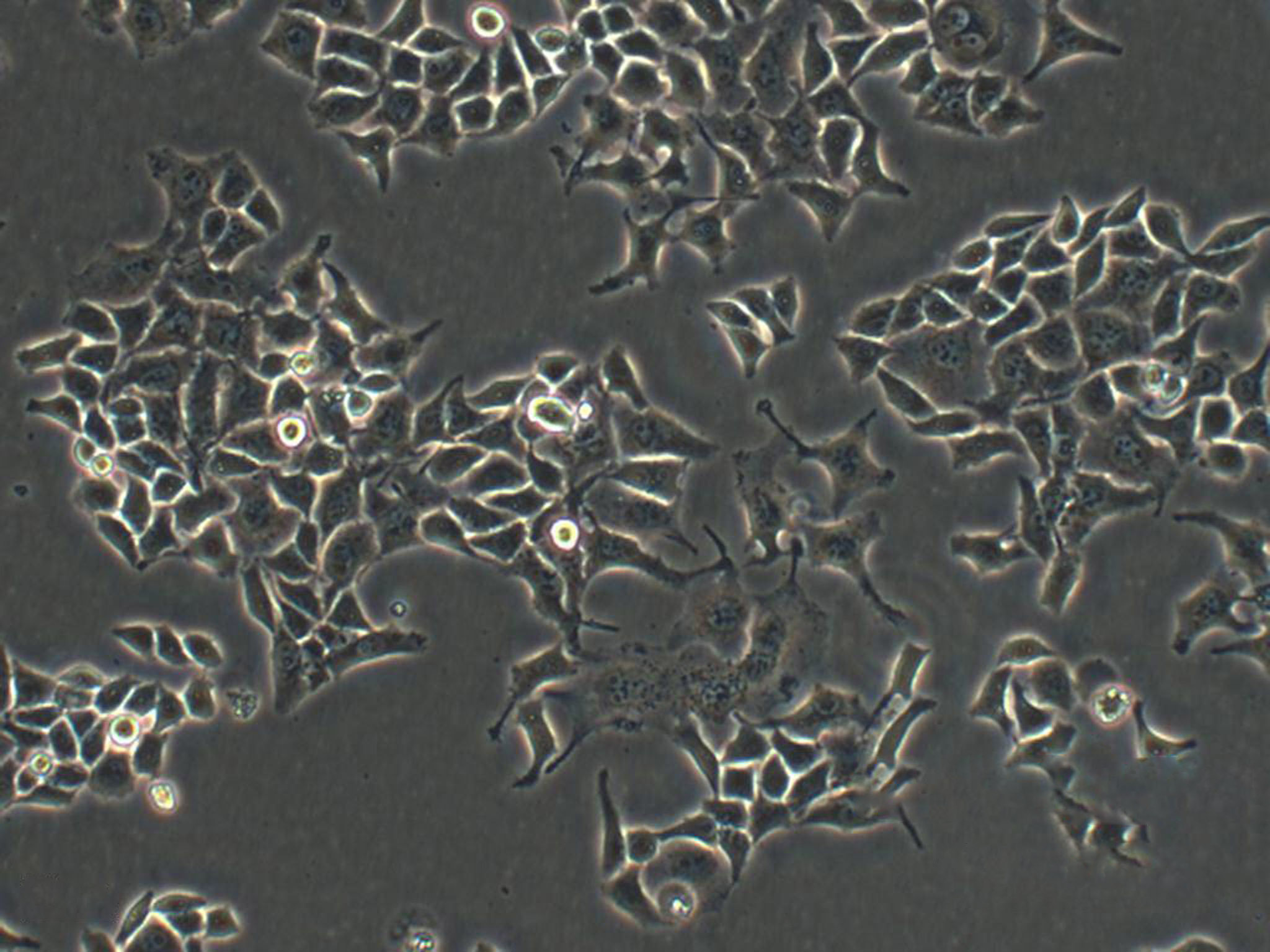 OE21:人食道鳞状癌复苏细胞(提供STR鉴定图谱)