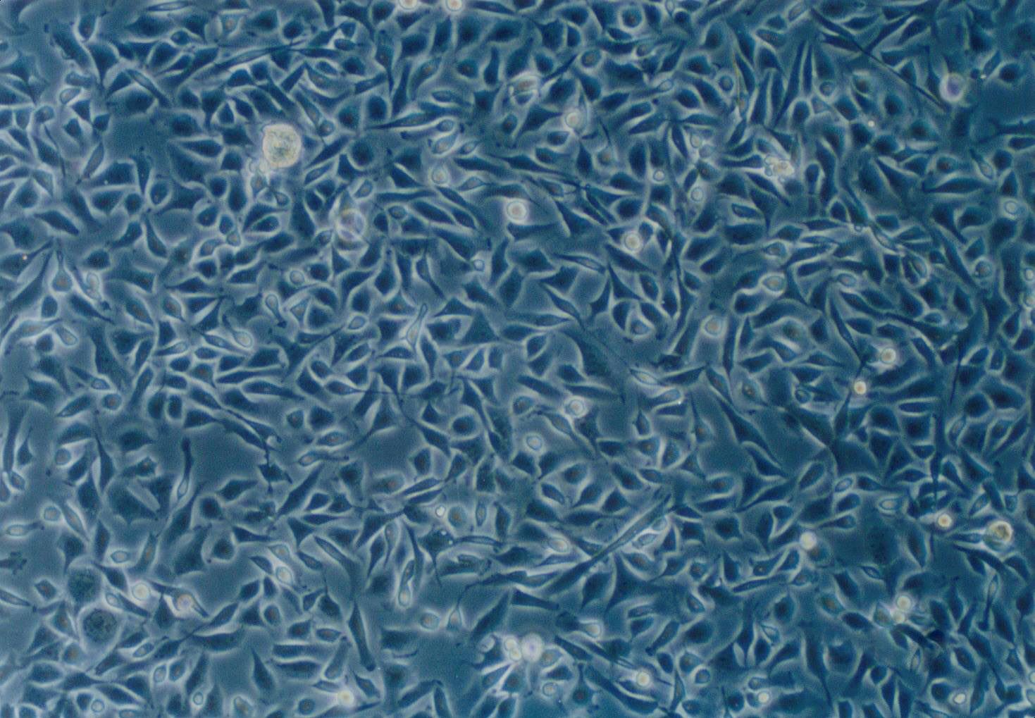 HBZY-1:大鼠肾小球系膜复苏细胞(提供STR鉴定图谱)