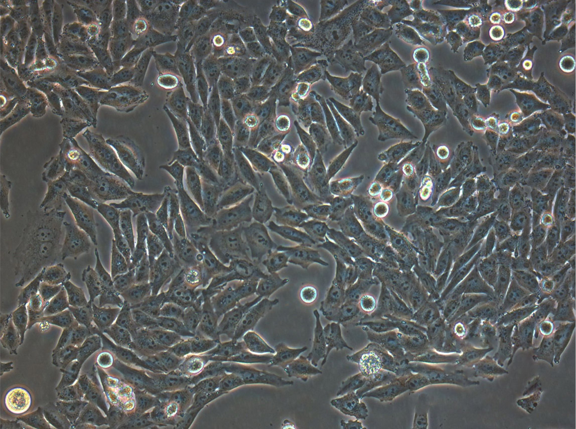 KLE:人子宫内膜癌复苏细胞(提供STR鉴定图谱)
