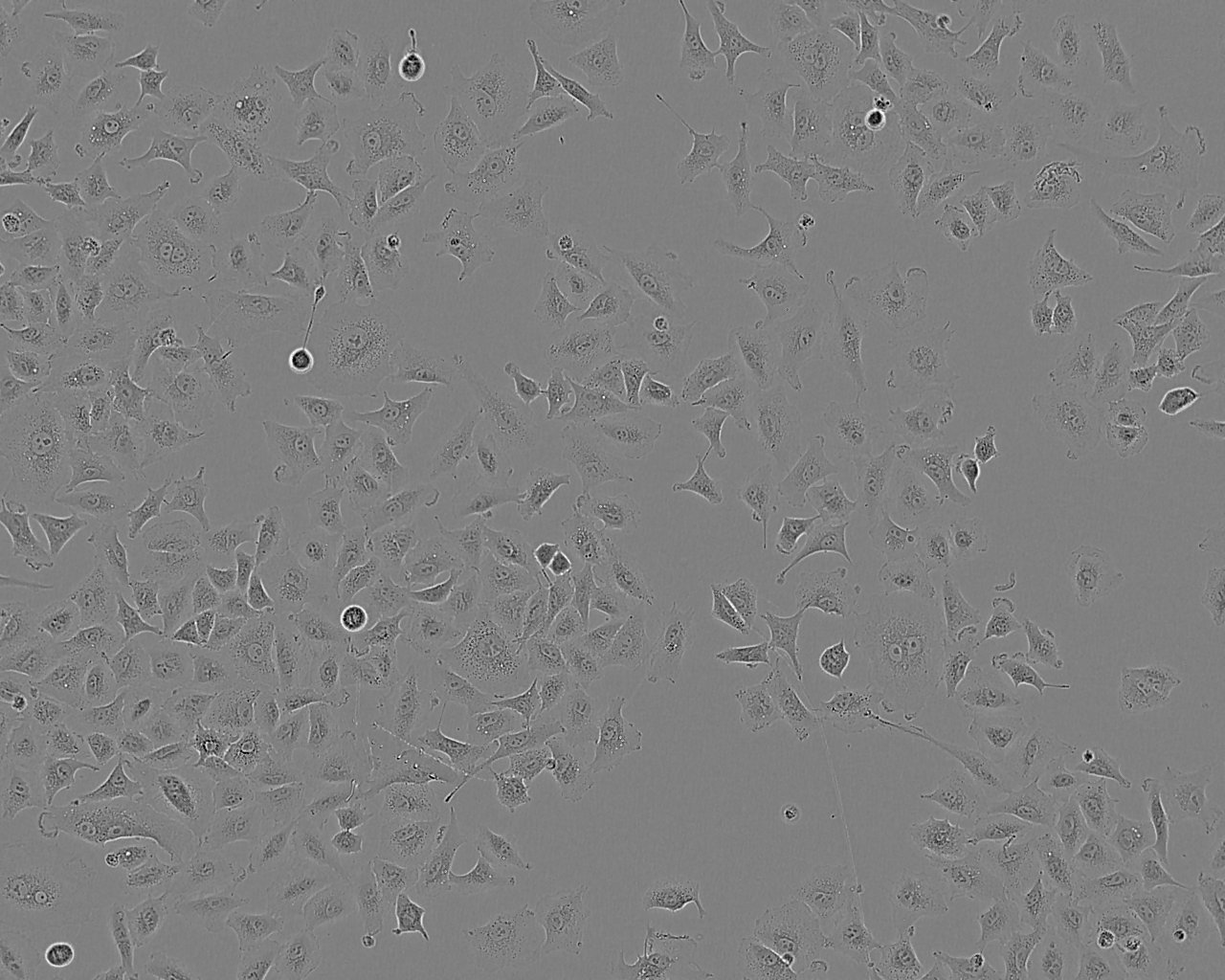 WPMY-1:人正常前列腺基质永生化复苏细胞(提供STR鉴定图谱)