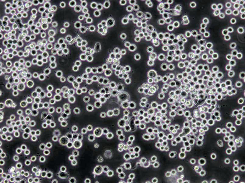 HEL 299 Cells(赠送Str鉴定报告)|人红白细胞白血病细胞