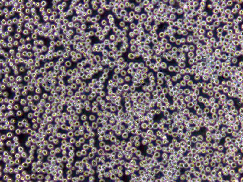 CII Cells(赠送Str鉴定报告)|人慢性淋巴细胞白血病细胞