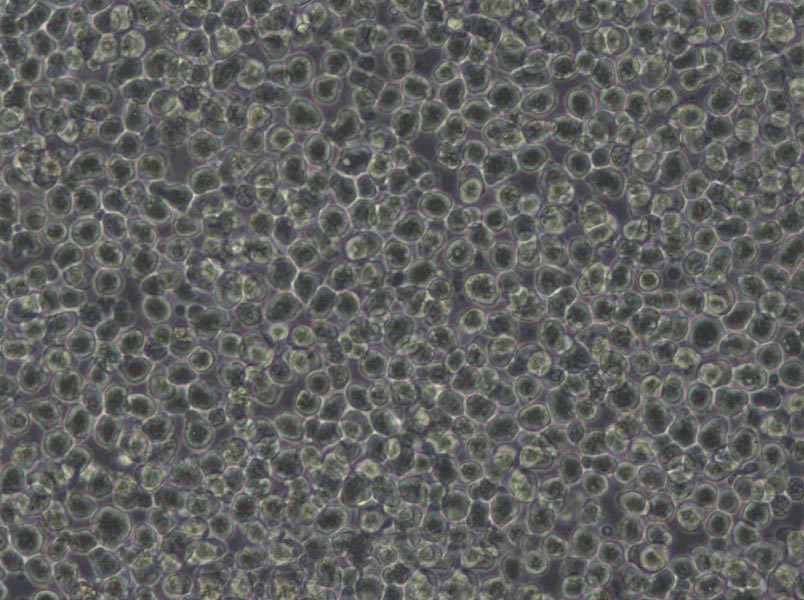 L-428 Cells(赠送Str鉴定报告)|人霍奇金淋巴瘤细胞
