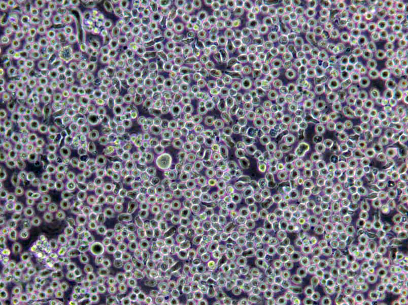 L-540 Cells(赠送Str鉴定报告)|人霍奇金淋巴瘤细胞