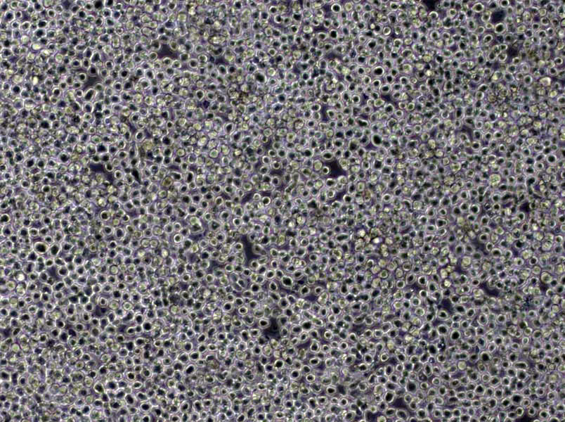 Nb2-11 Cells(赠送Str鉴定报告)|大鼠淋巴瘤细胞