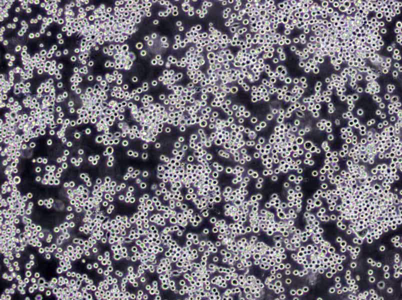 CESS Cells(赠送Str鉴定报告)|人急性髓系白血病细胞