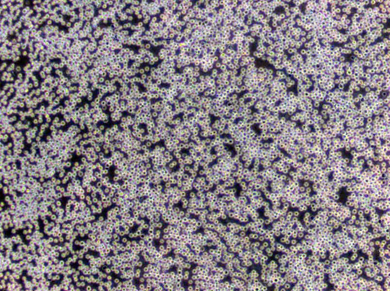 OCI-AML-4 Cells(赠送Str鉴定报告)|人急性髓系白血病细胞