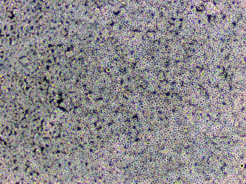 C1498 Cells(赠送Str鉴定报告)|小鼠白血病细胞