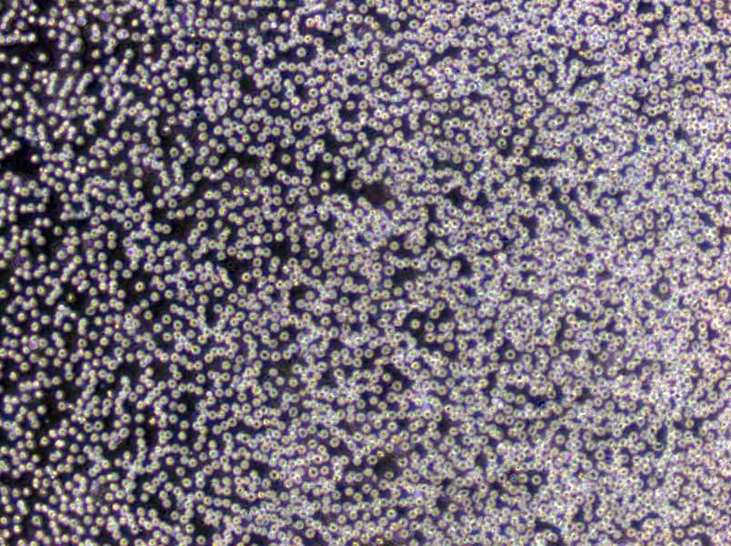 CCRF-SB Cells(赠送Str鉴定报告)|人急性T淋巴细胞白血病细胞