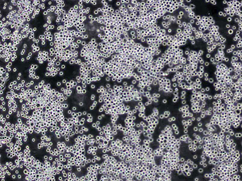 NK-92MI Cells(赠送Str鉴定报告)|人恶性非霍奇金淋巴瘤患者NK细胞