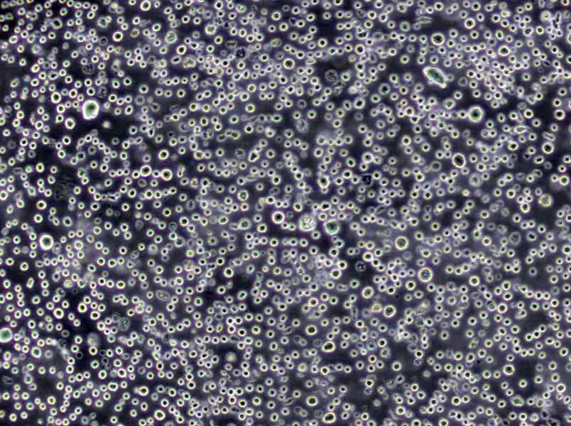 TMD8 Cells(赠送Str鉴定报告)|人弥漫大B淋巴瘤细胞