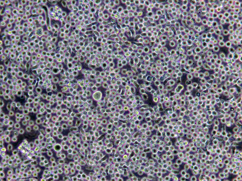 A20 Cells(赠送Str鉴定报告)|小鼠B细胞淋巴瘤细胞