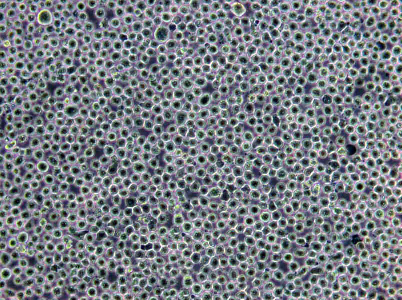 OCI-AML-3 Cells(赠送Str鉴定报告)|人急性髓细胞性白血病细胞