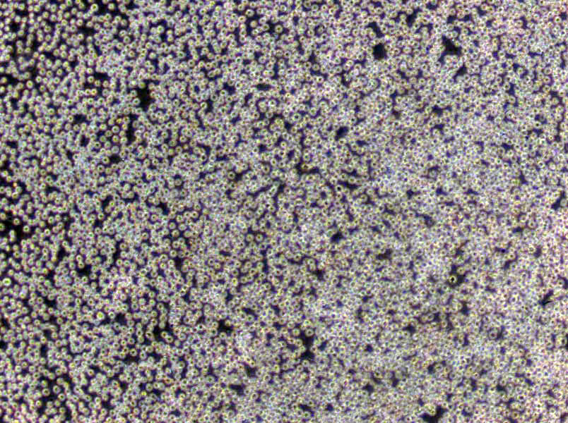 SU-DHL-4 Cells(赠送Str鉴定报告)|人弥漫性组织淋巴瘤细胞
