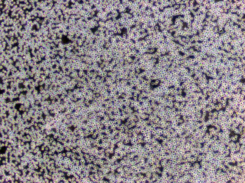 P30/OHK Cells(赠送Str鉴定报告)|人急性淋巴白血病细胞