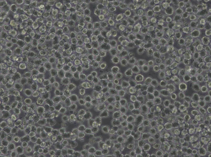 Namalwa Cells(赠送Str鉴定报告)|人Burkitt＇s淋巴瘤细胞