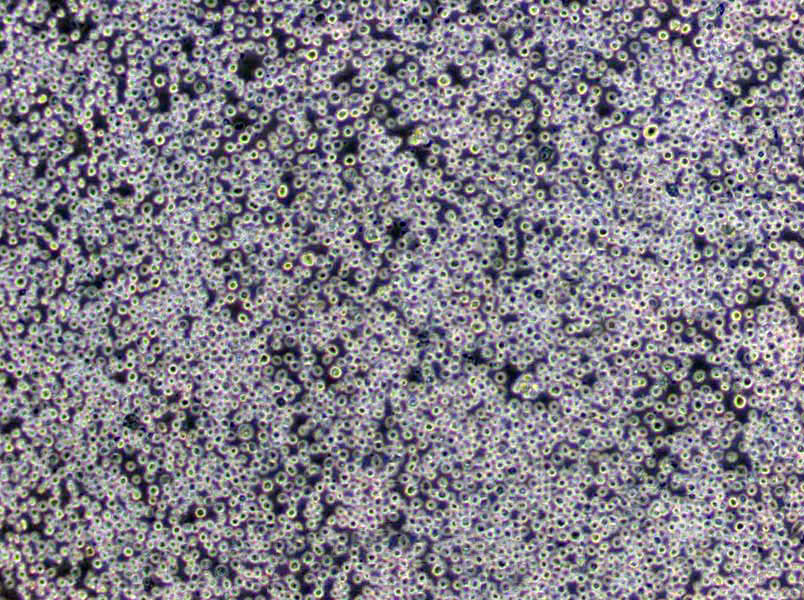 CTLL-2 Cells(赠送Str鉴定报告)|小鼠T淋巴细胞