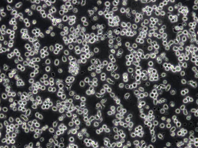 BALL-1 Cells(赠送Str鉴定报告)|人B淋巴细胞急性白血病细胞