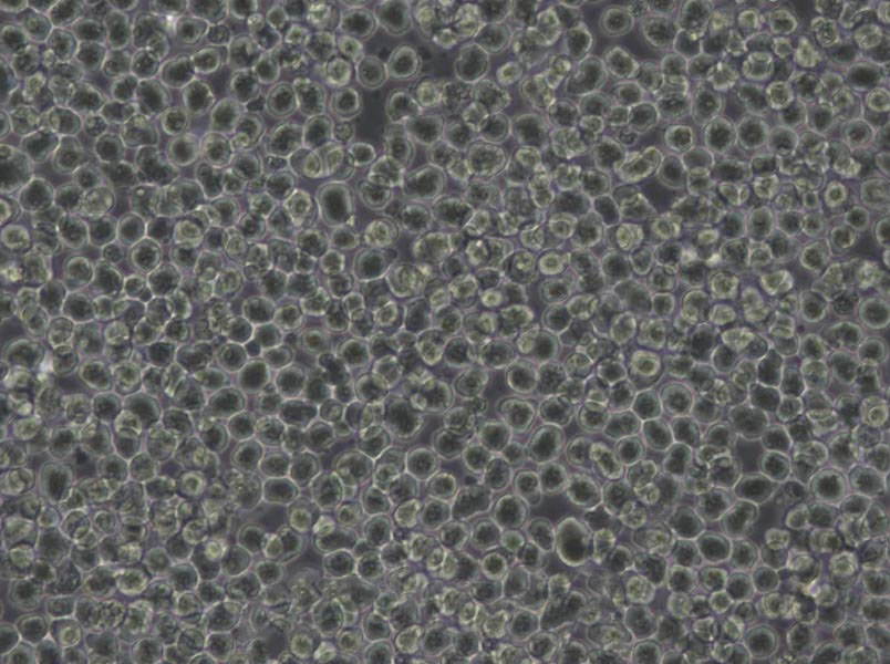 MT-4 Cells(赠送Str鉴定报告)|人急性淋巴母细胞白血病细胞