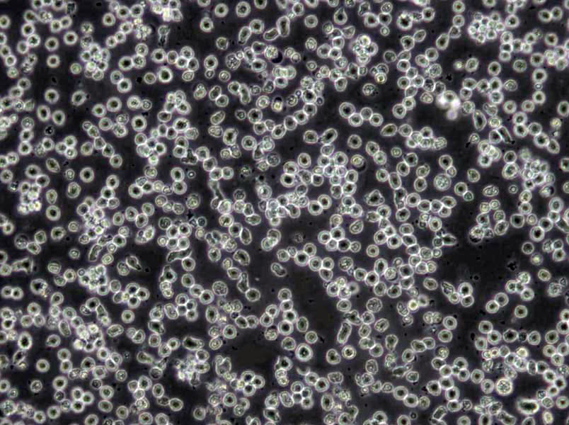 MOLT-4 Cells(赠送Str鉴定报告)|人急性淋巴母细胞性白血病细胞