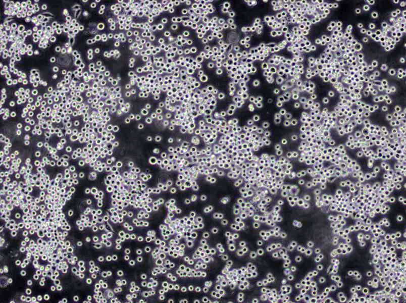 HL-60 Cells(赠送Str鉴定报告)|人原髓细胞白血病细胞