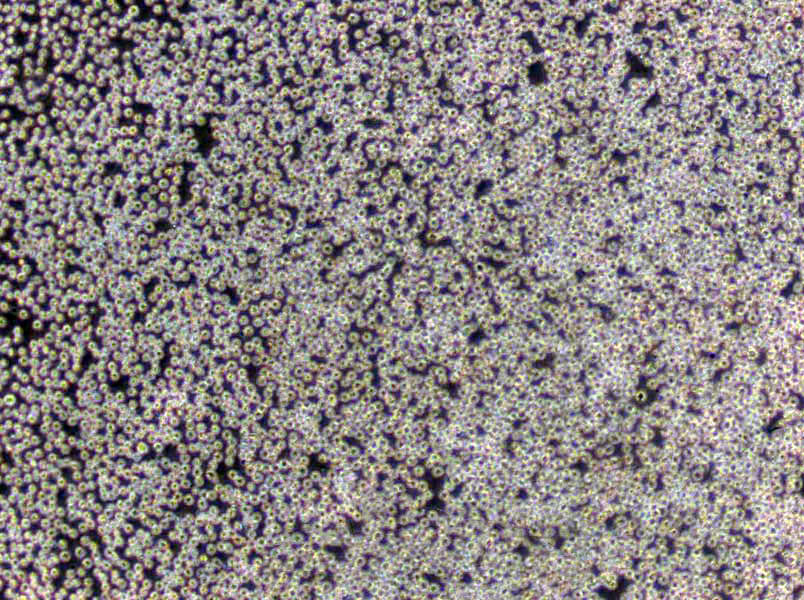 GM00637 Cells(赠送Str鉴定报告)|人皮肤成纤维细胞