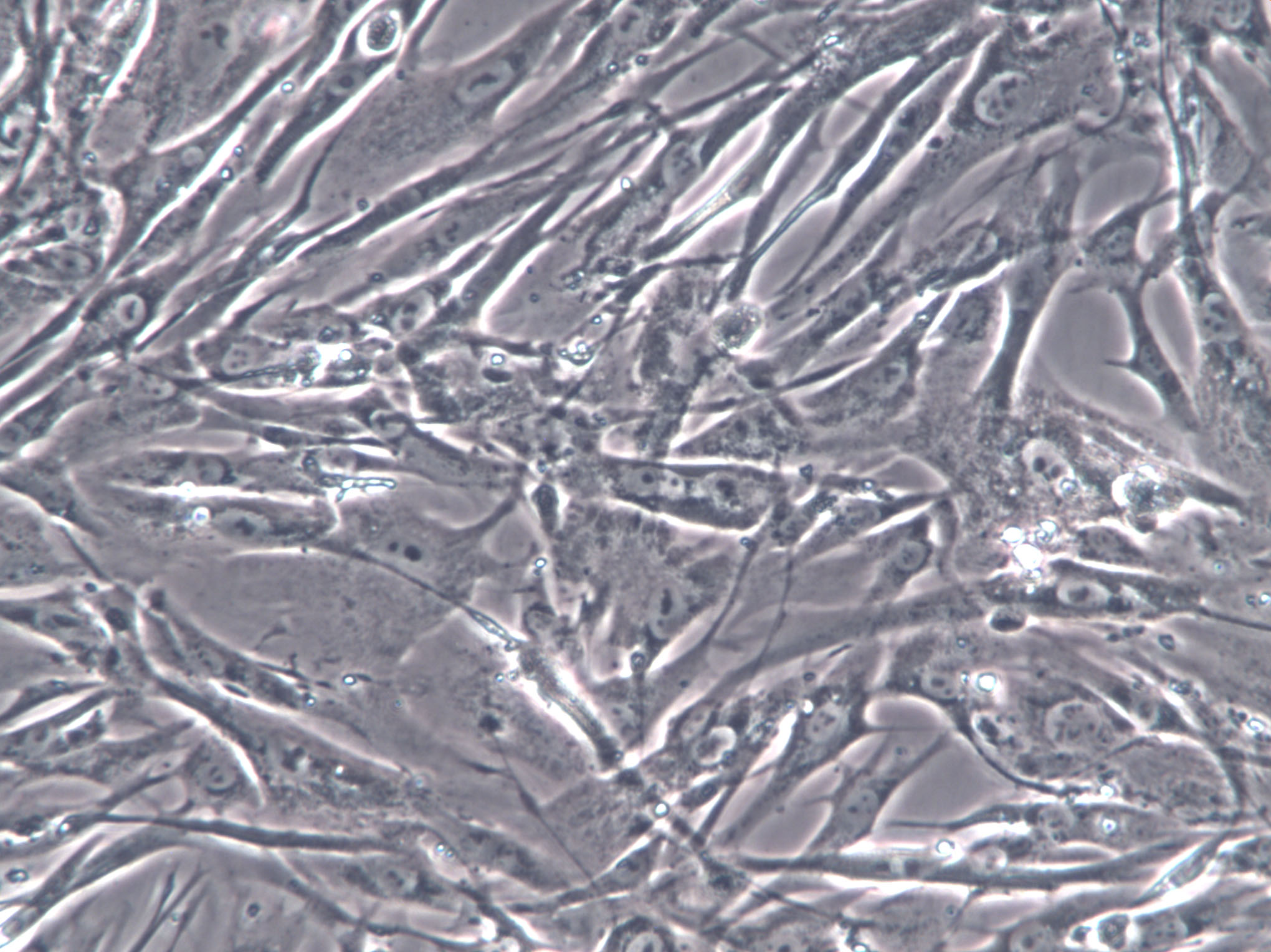 NRK-49F Cells(赠送Str鉴定报告)|大鼠正常肾成纤维细胞