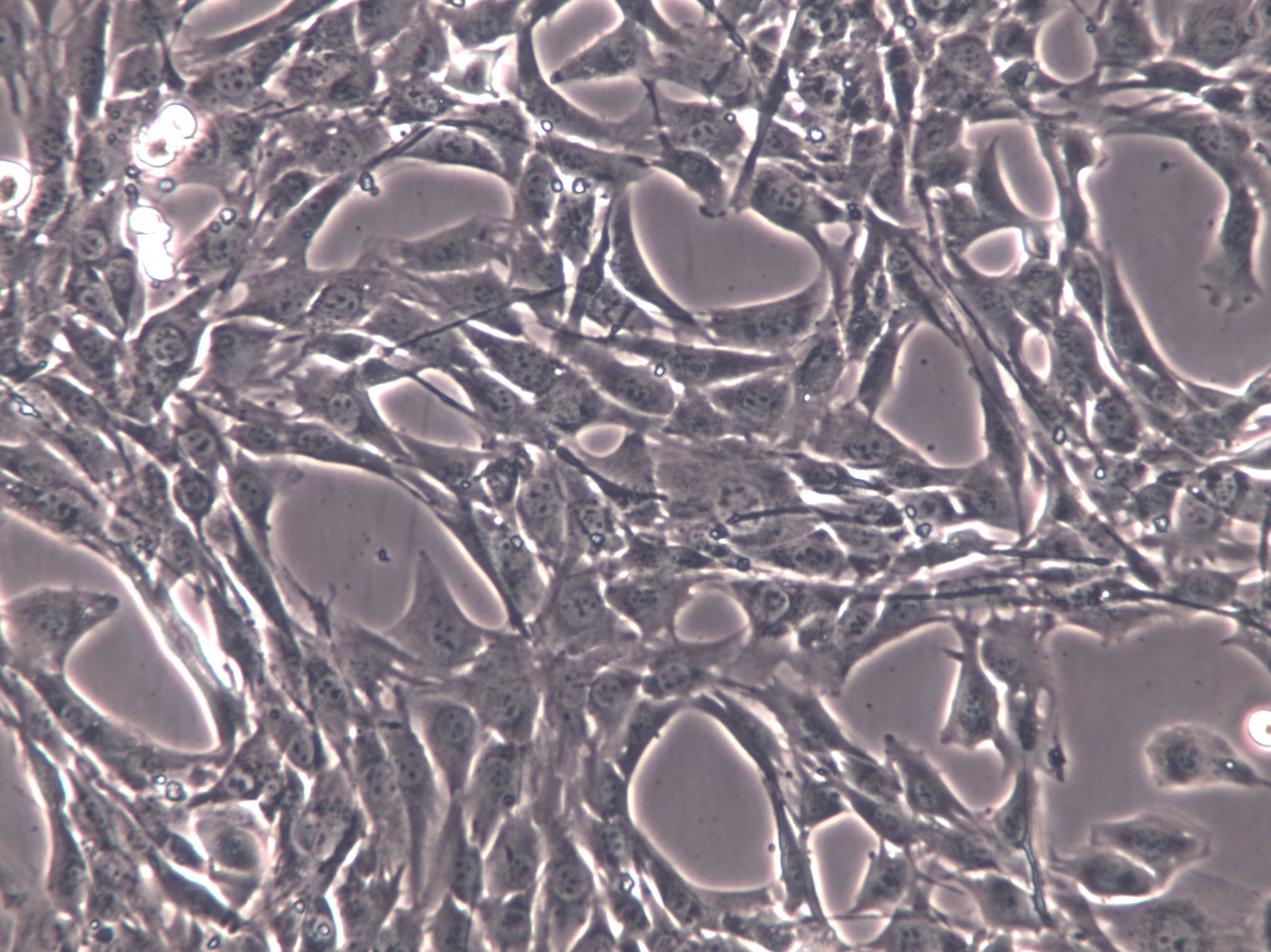 BALB/3T3 clone A31 Cells(赠送Str鉴定报告)|小鼠胚胎成纤维细胞