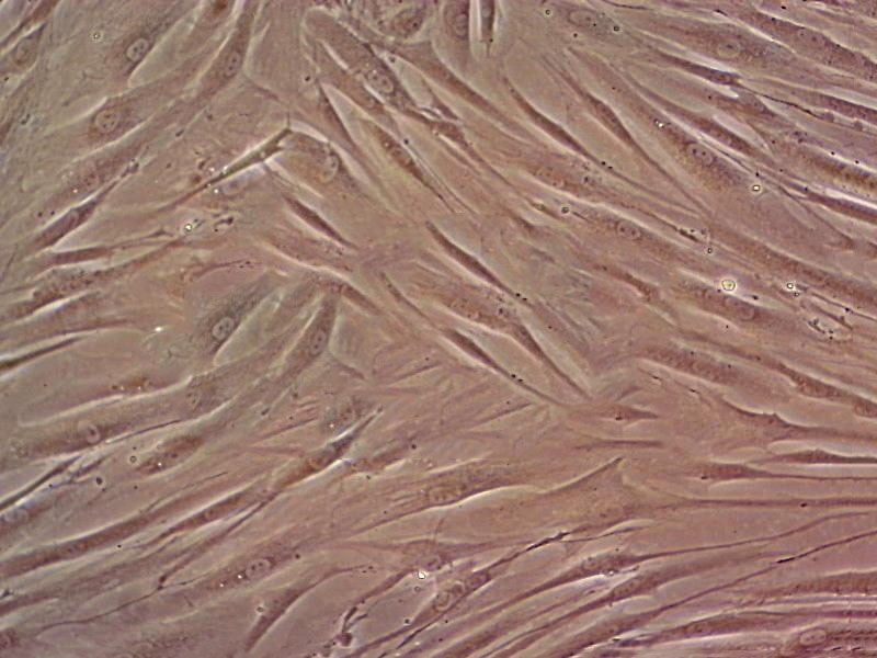 BJ [Human fibroblast] Cells(赠送Str鉴定报告)|人皮肤成纤维细胞