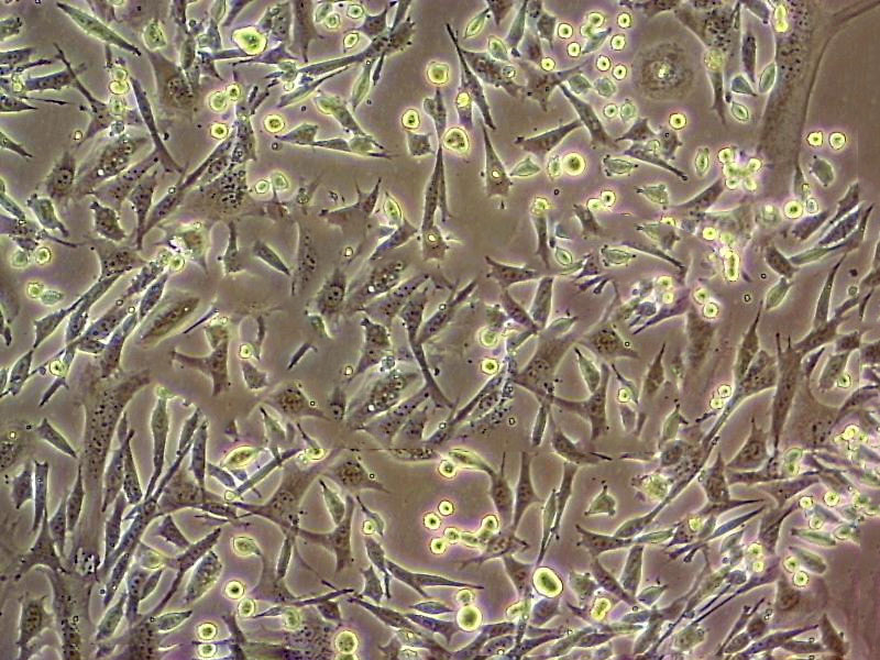 MRC-5 Cells(赠送Str鉴定报告)|人胚肺成纤维细胞