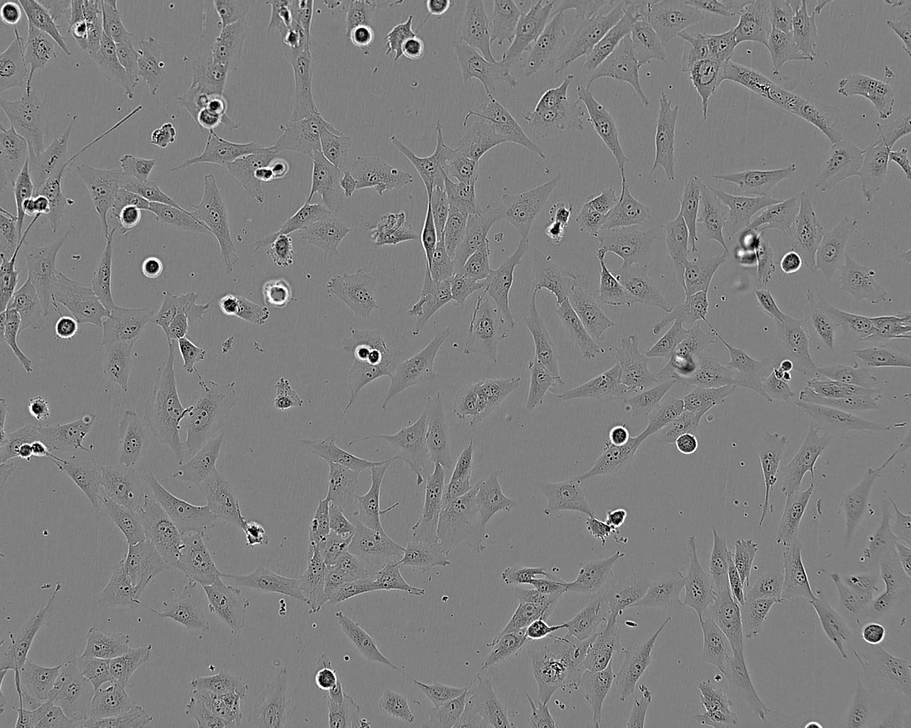 SK-RC-39 Cells(赠送Str鉴定报告)|人肾乳头状细胞癌细胞