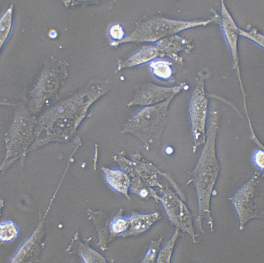 UM2 Cells(赠送Str鉴定报告)|人舌鳞癌细胞