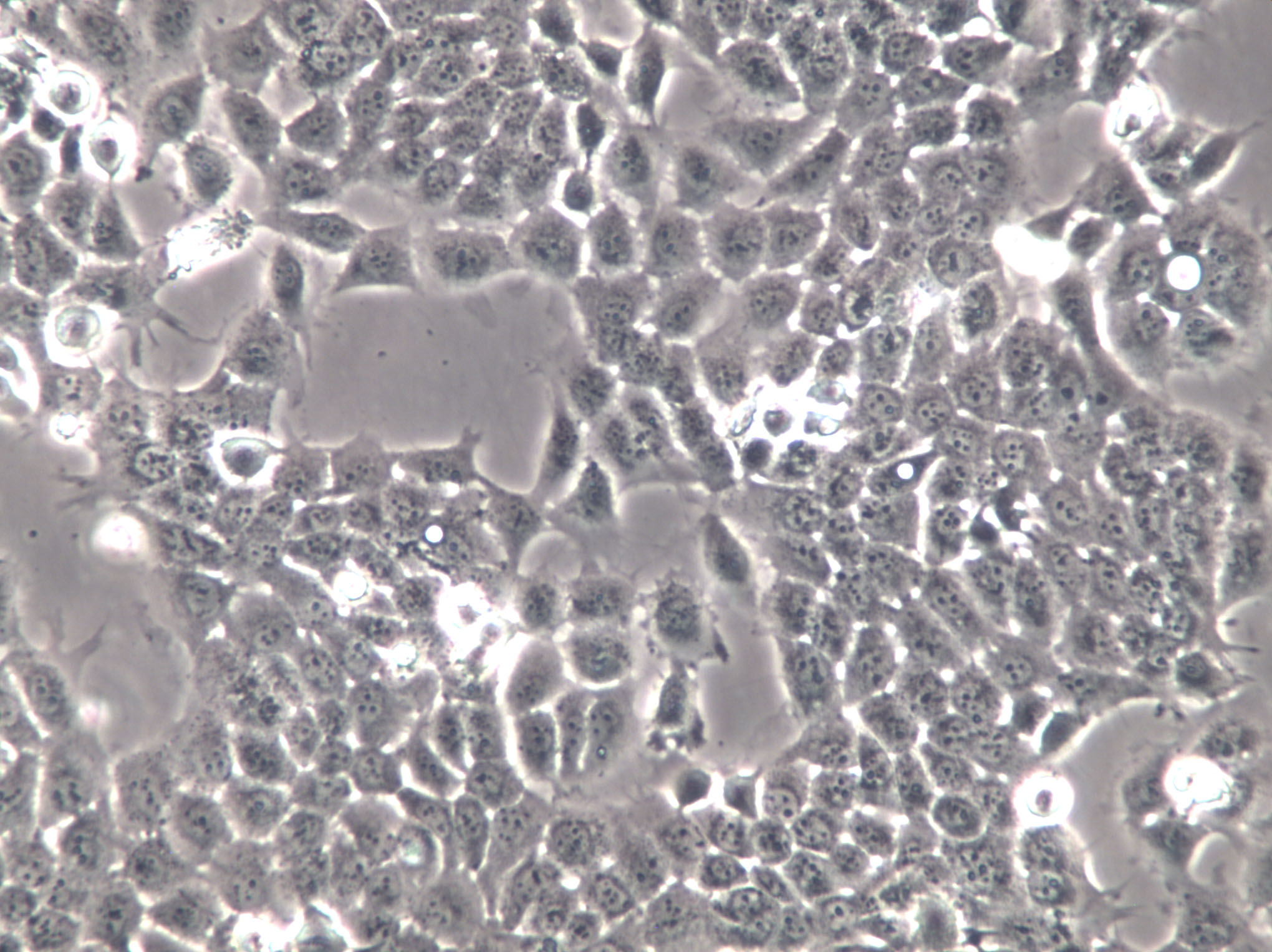 EFO-27 Cells(赠送Str鉴定报告)|人卵巢腺癌细胞