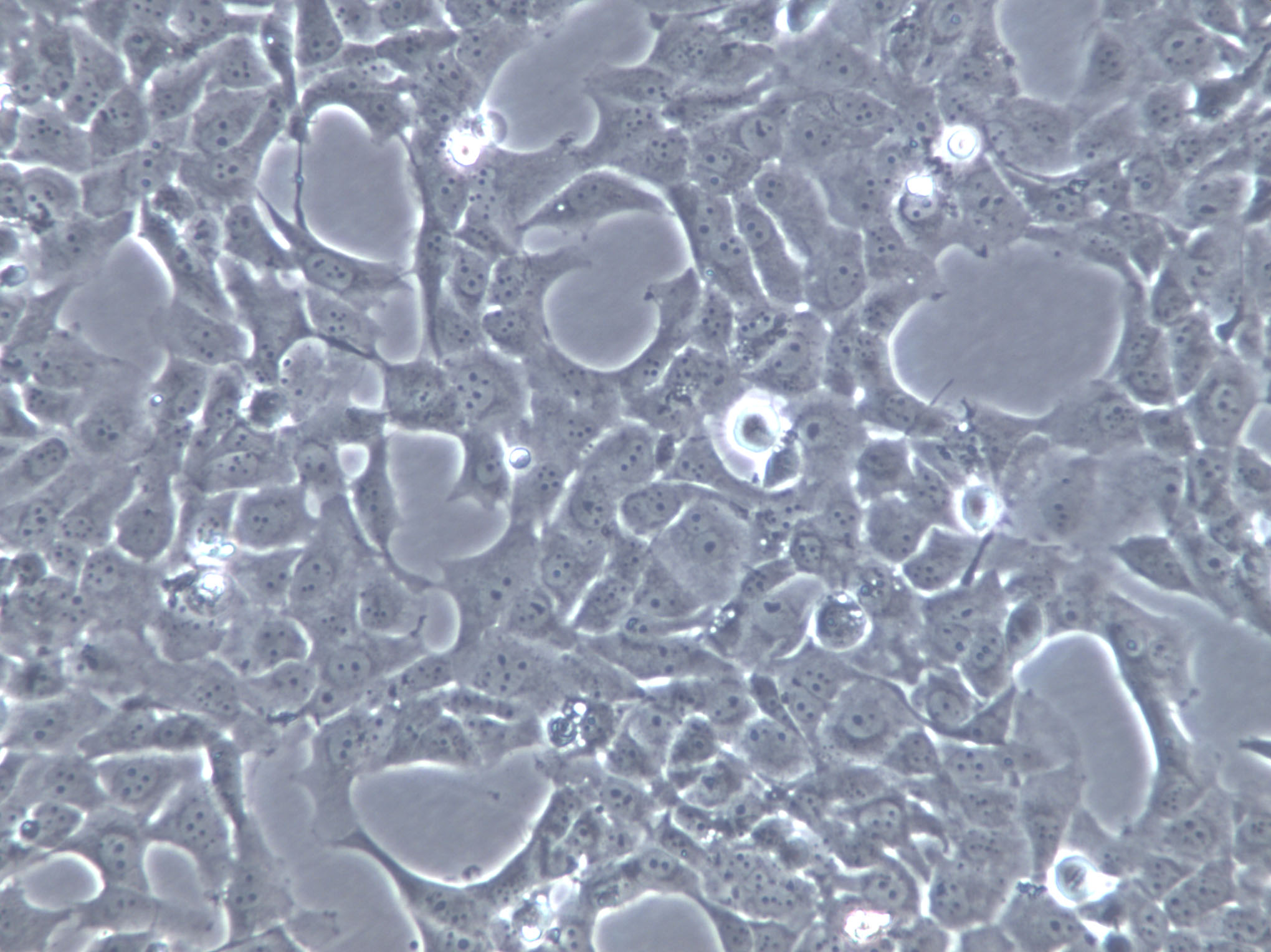 HCC1438 Cells(赠送Str鉴定报告)|人肺癌细胞