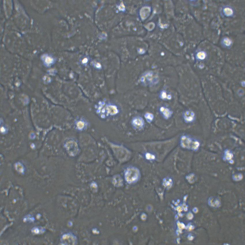 SNU-520 Cells(赠送Str鉴定报告)|人胃癌细胞