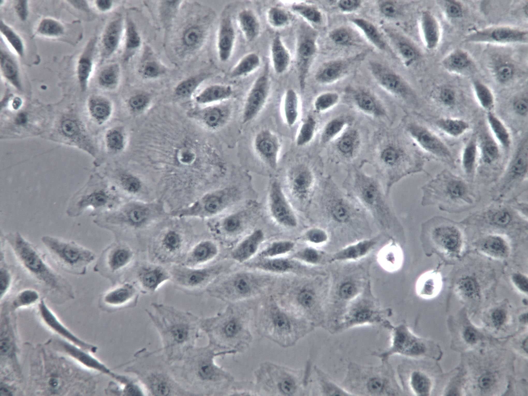 PAMC82 Cells(赠送Str鉴定报告)|人胃癌细胞