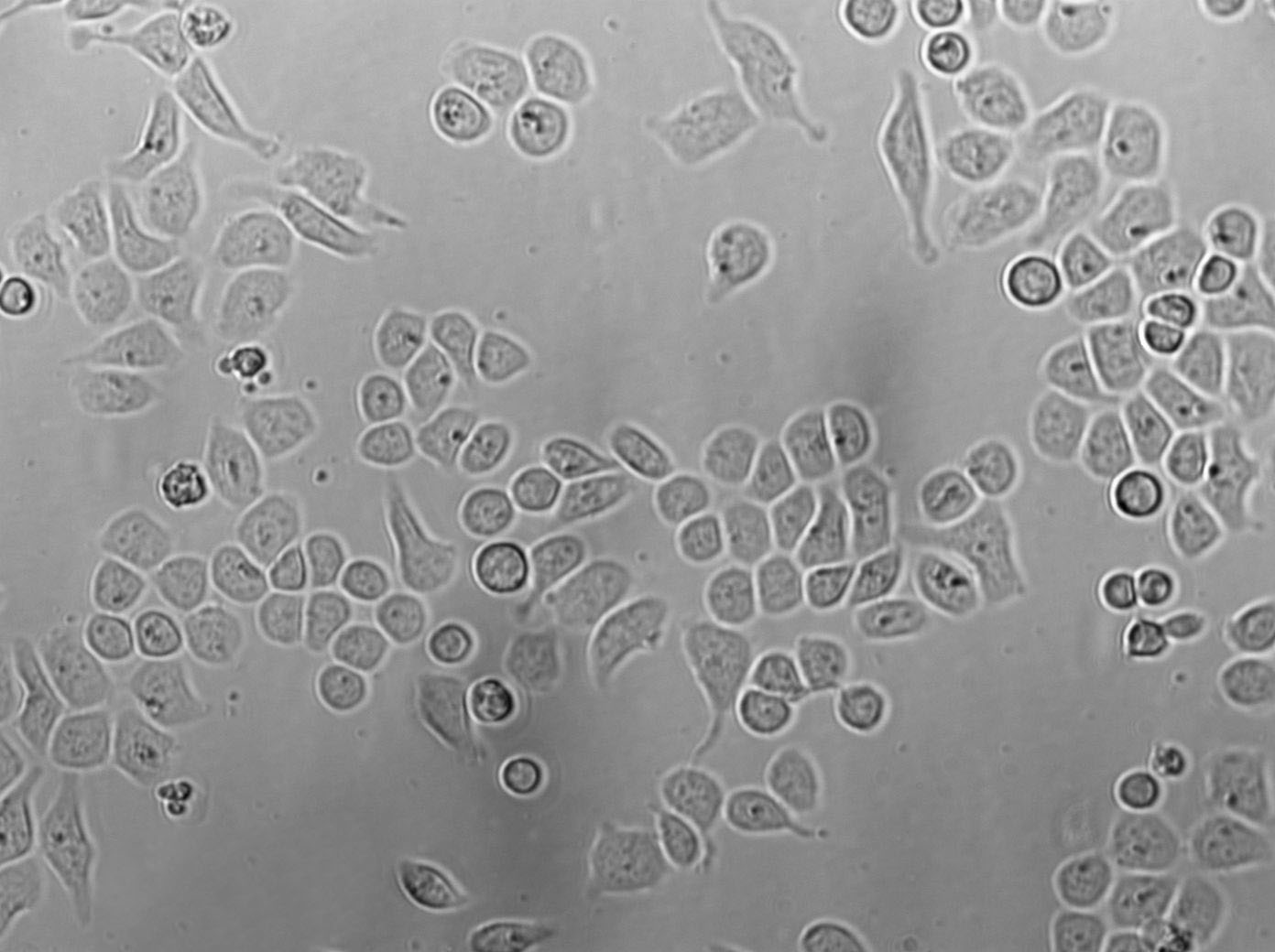 TE-12 Cells(赠送Str鉴定报告)|人食道癌肿瘤细胞