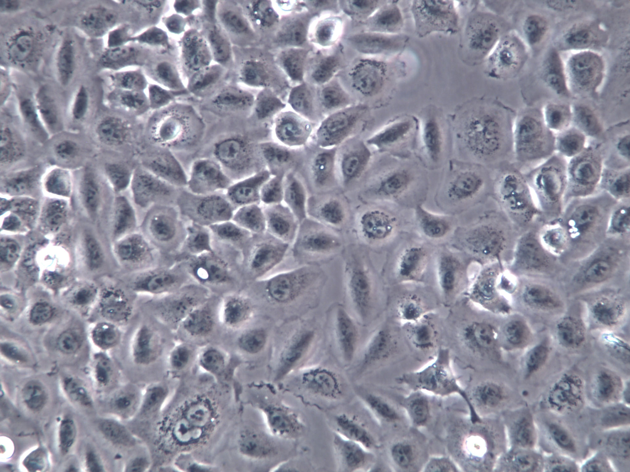 HCC1008 Cells(赠送Str鉴定报告)|人乳腺导管癌细胞