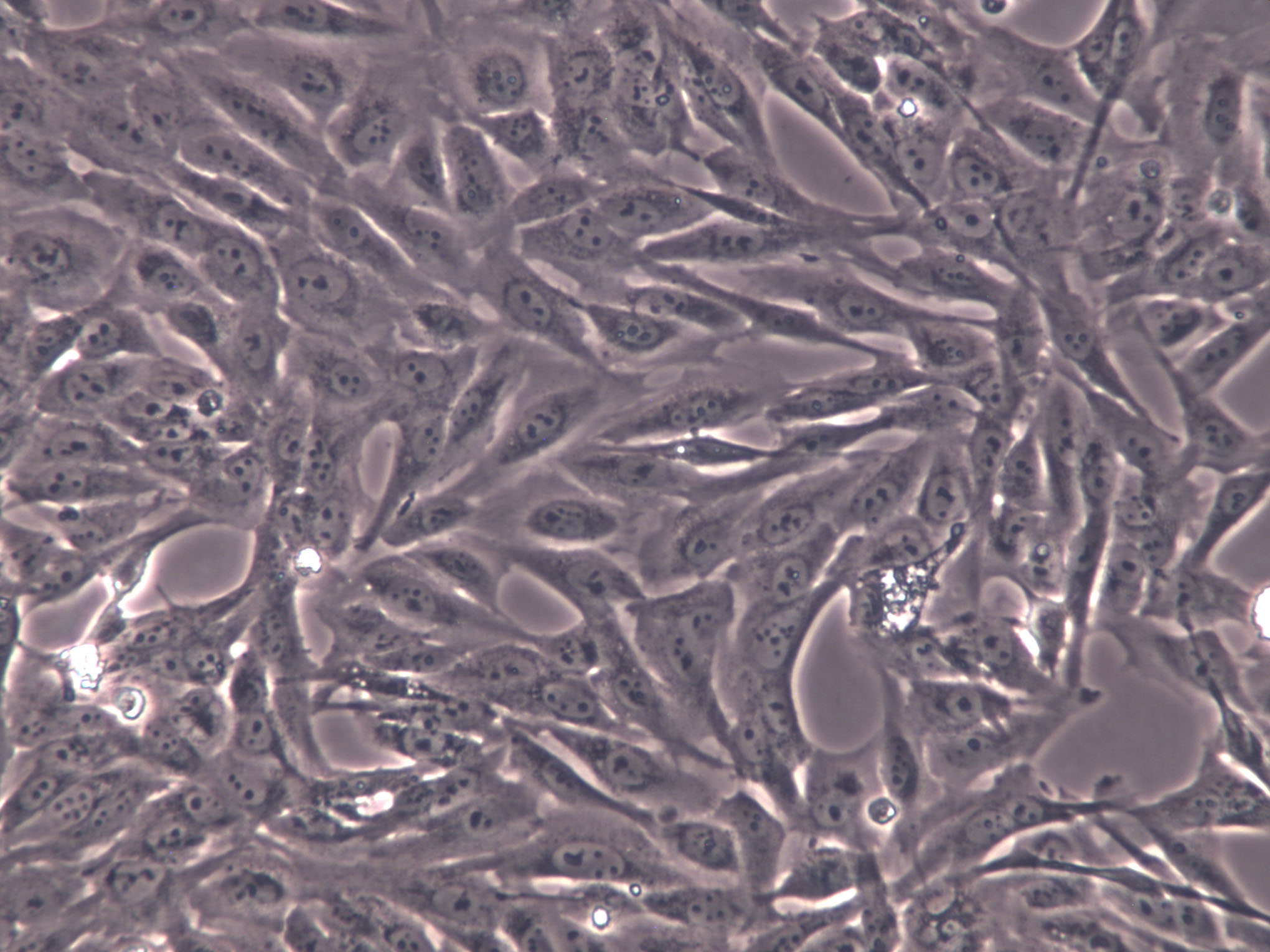 NCI-H1954 Cells(赠送Str鉴定报告)|人肺癌细胞