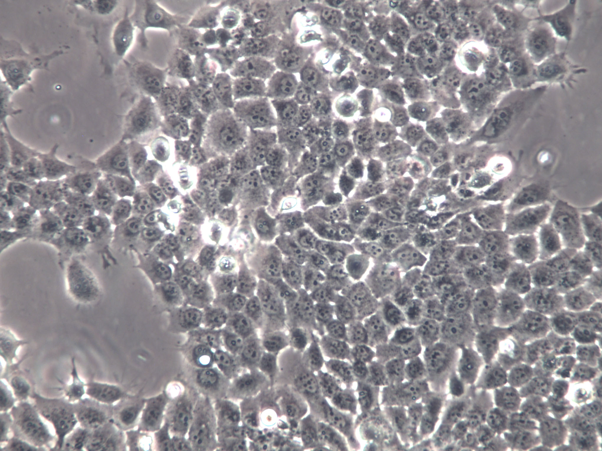 LUDLU-1 Cells(赠送Str鉴定报告)|人肺癌鳞癌细胞
