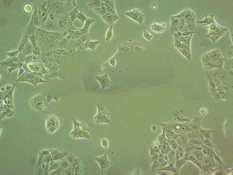 SK-N-BE(2)-M17 Cells|人成神经克隆细胞(包送STR鉴定报告)