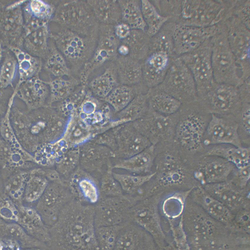 HEK-2 Cells|人胚肾二倍体克隆细胞(包送STR鉴定报告)