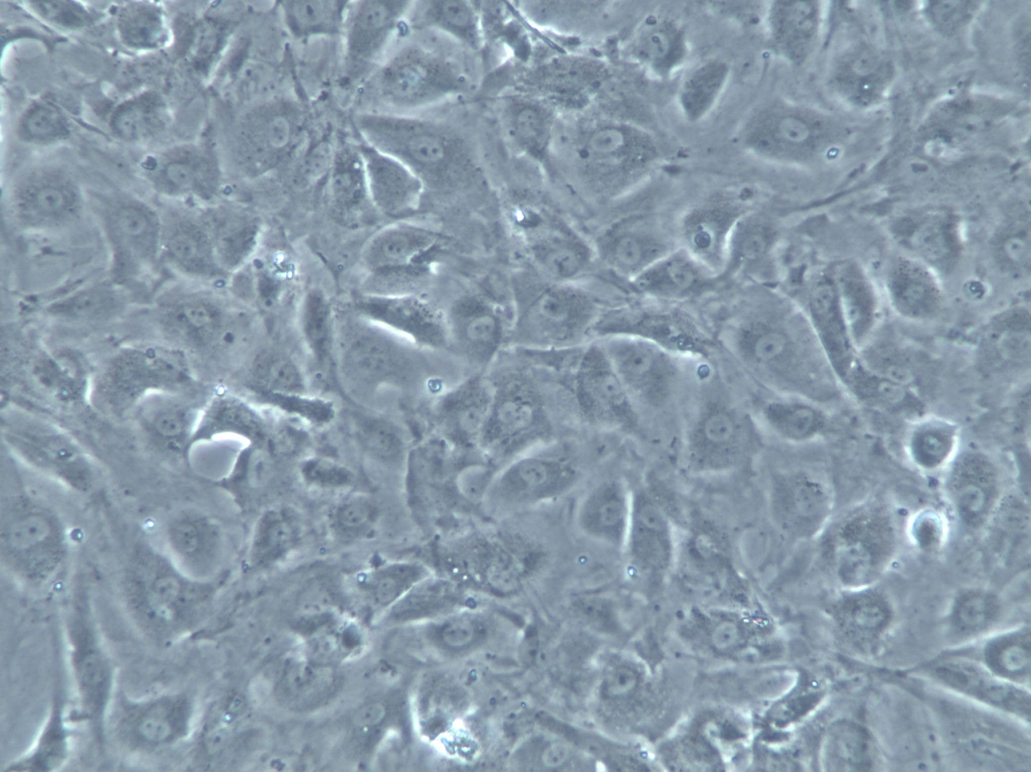 LP-1 Cells|人多发性骨髓瘤白克隆细胞(包送STR鉴定报告)