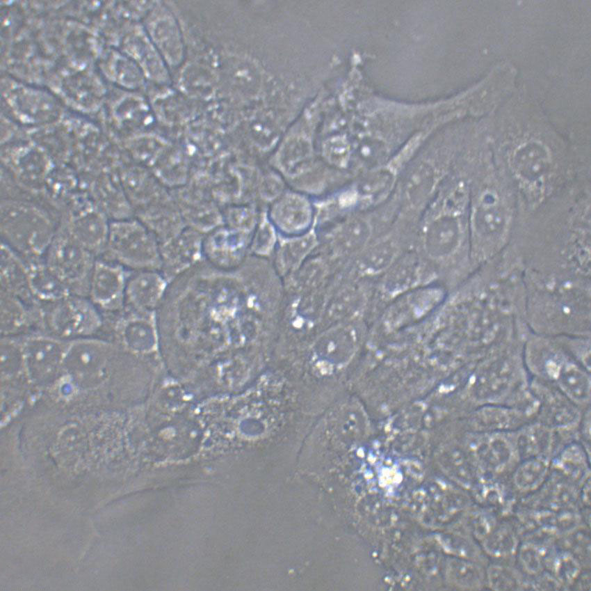 Hep-G2 Cells|人肝癌克隆细胞(包送STR鉴定报告)