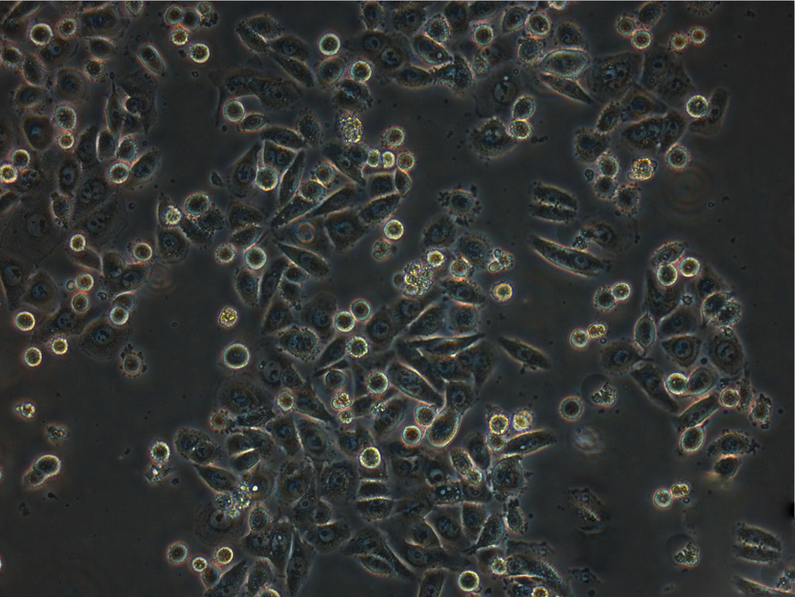 CX-1 Cells(赠送Str鉴定报告)|人大肠癌细胞
