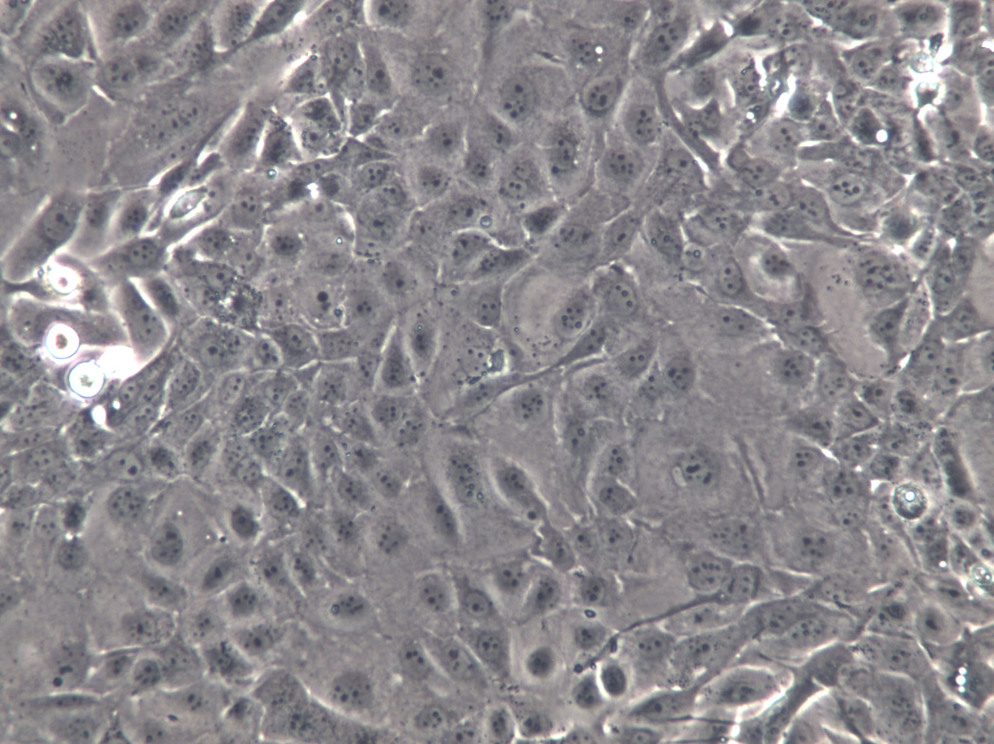 SW1271 Cells(赠送Str鉴定报告)|人肺腺癌细胞